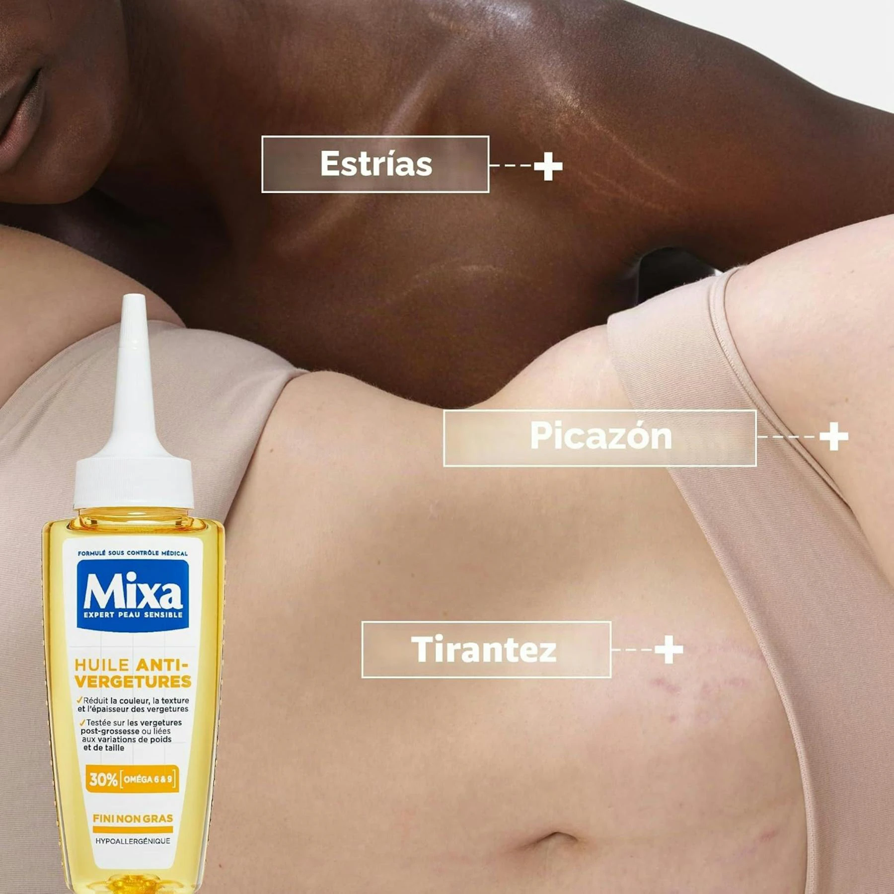Aceite Antiestrías No Graso Mixa 100 Ml