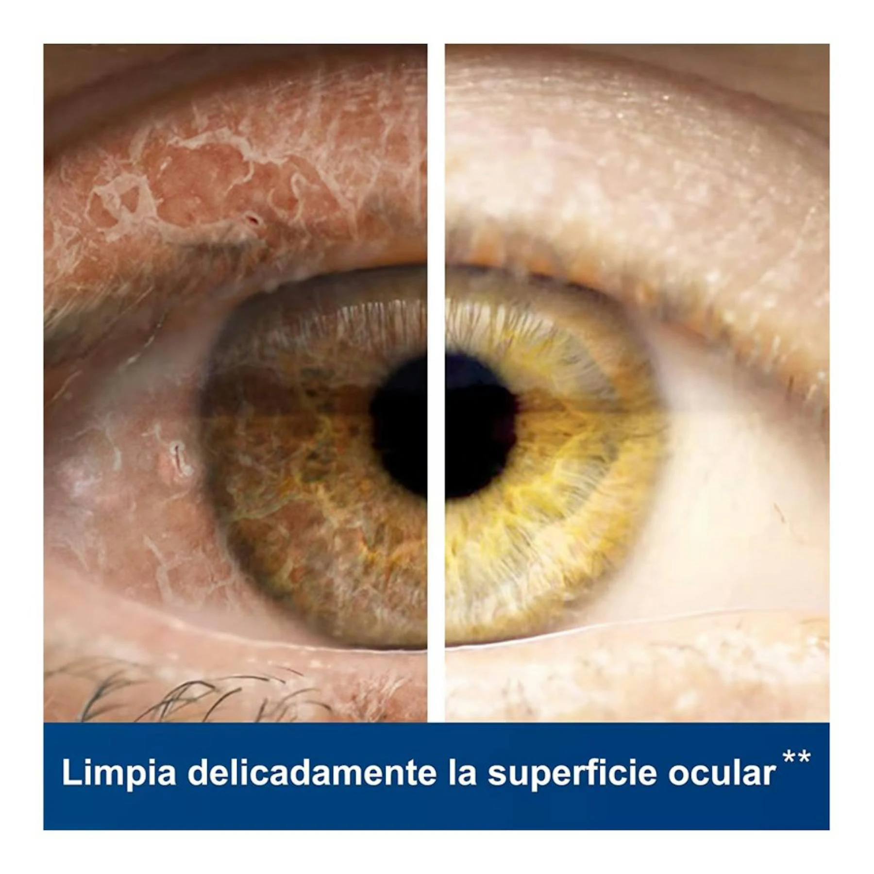 Colírio Água De Hamamélis Optrex 10Ml