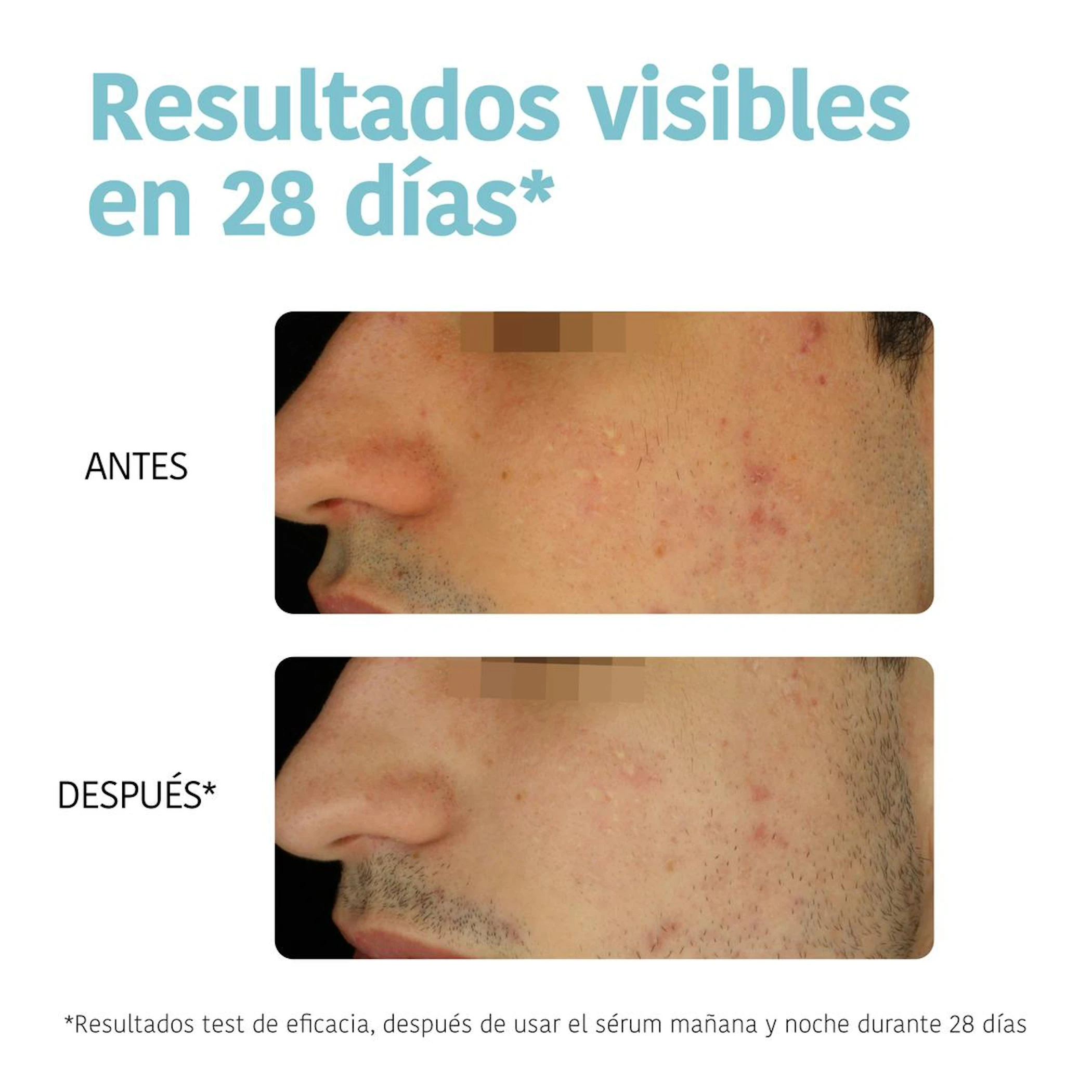 Sérum Facial Anti-Imperfeições Prevent & Correct Iroha Nature 30Ml
