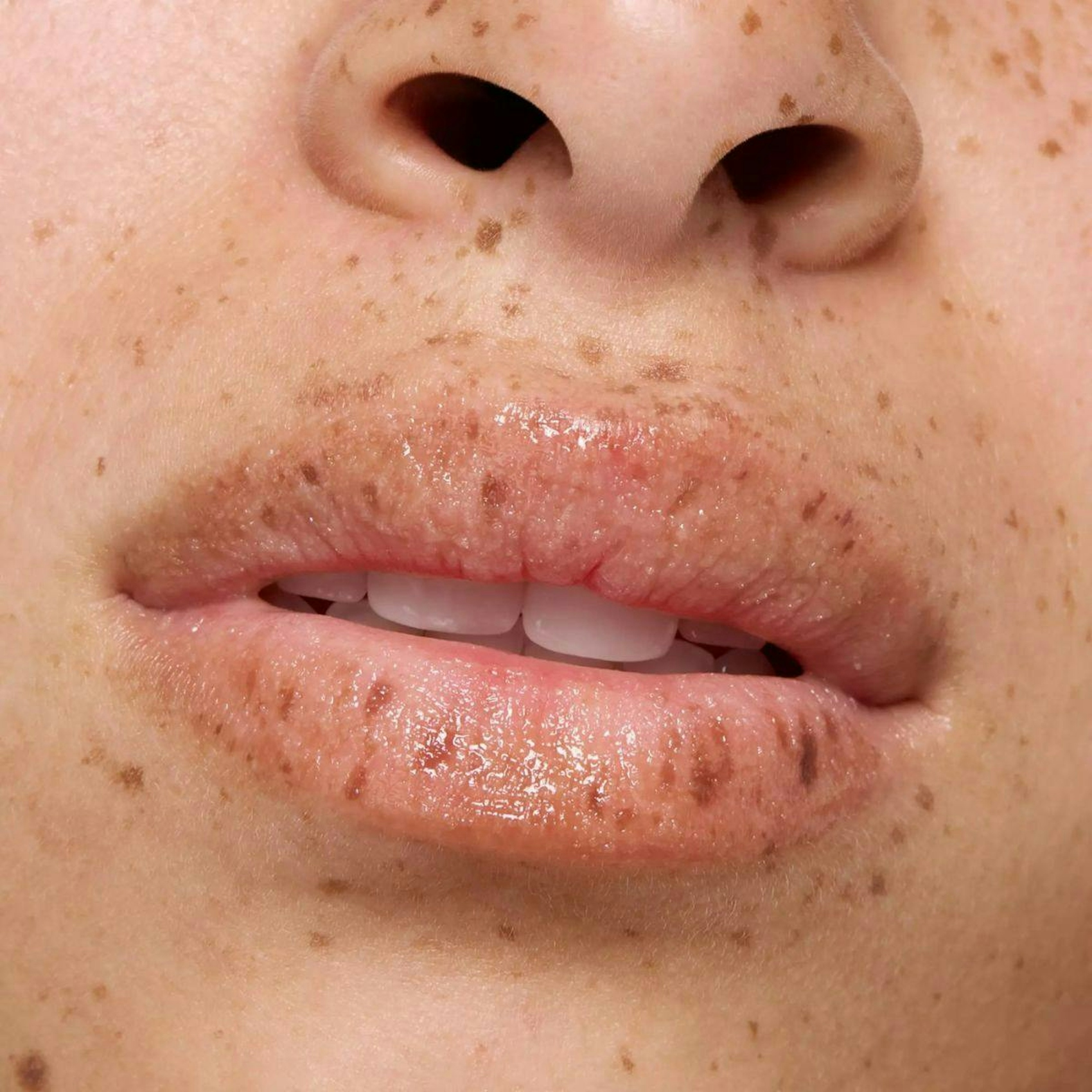 Exfoliante Labial Sugar Scrub Essence