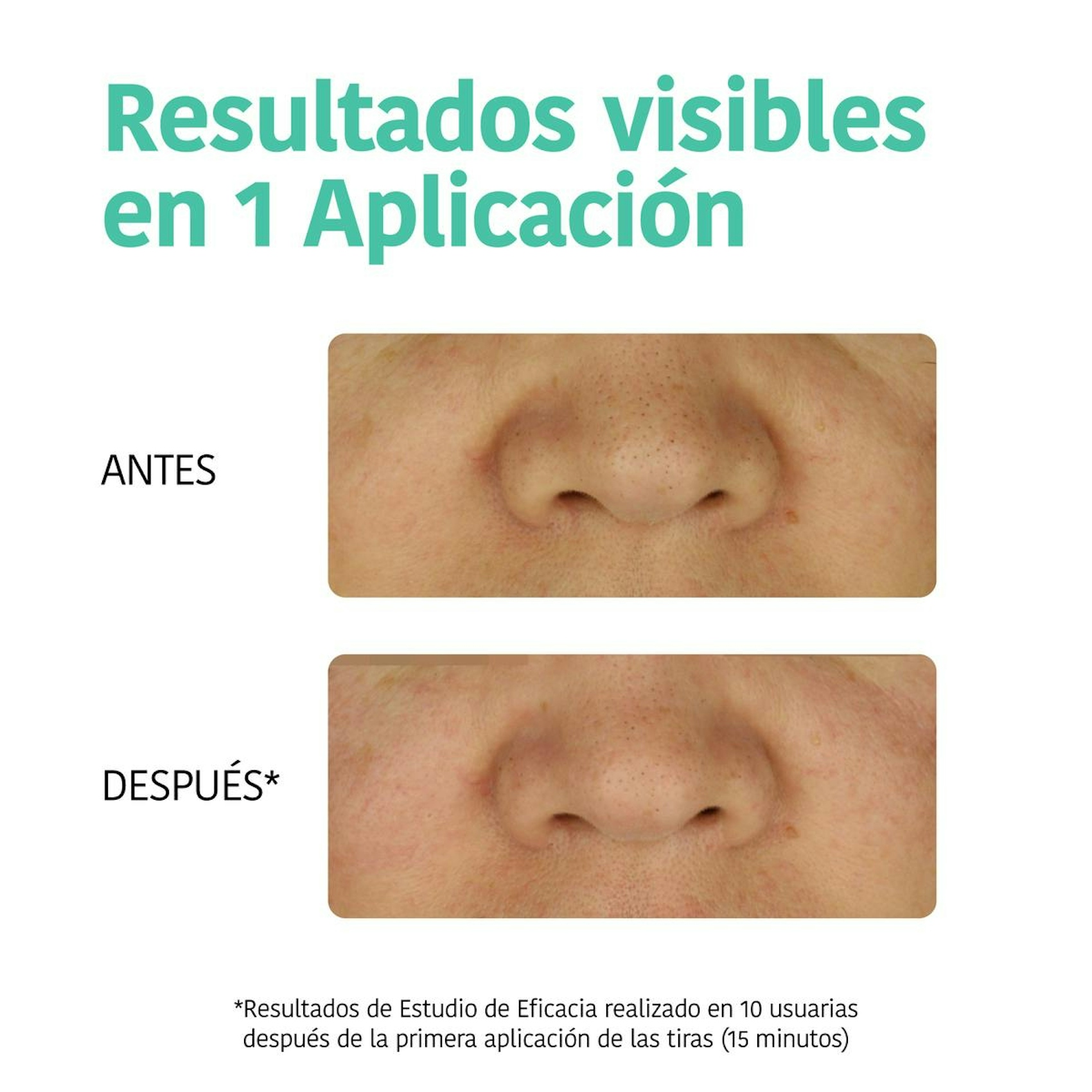 Parches De Nariz Limpieza De Puntos Negros Carbón Iroha Nature 5 Uds